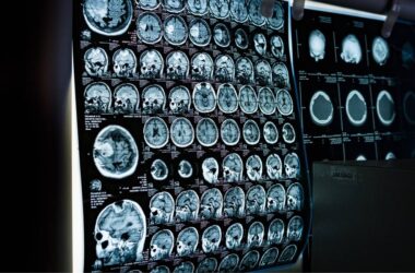 GESSEL doradzała Lux Med przy przejęciu TMS Diagnostyka