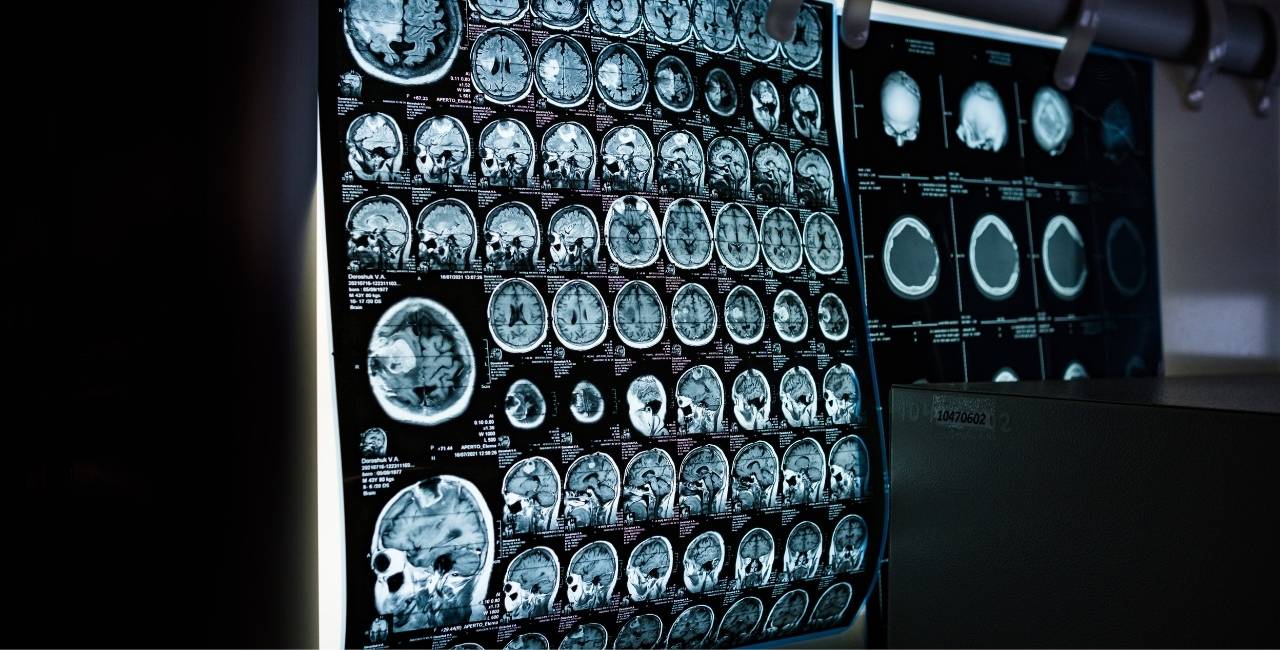 GESSEL doradzała Lux Med przy przejęciu TMS Diagnostyka
